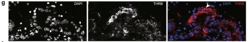 THRB Antibody - Fig.