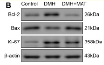 Ki67 Antibody - Figure 1.