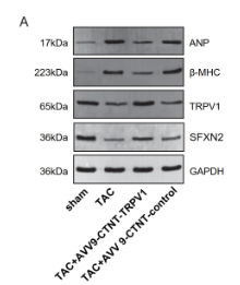 NPPA Antibody - Fig.