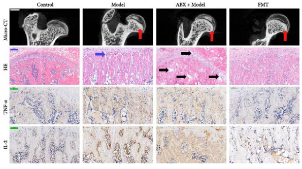 IL2 Antibody - Figure 2 (C) FMT alleviate the progress of GA-ONFH and decrease the expression of TNF-α and IL-2.