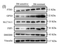 Ferritin Heavy Chain Antibody - FIGURE 1 Imatinib resistance is associated with ferroptosis activity in gastrointestinal stromal tumour (GIST).