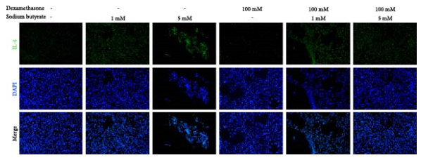IL4 Antibody - Figure 6 (C) The expression of TNF-α, IL-2, and IL-4 in BMSCs treated with different doses of sodium butyrate.