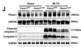 Hsp90 beta Antibody - Figure 3 Myeloid deletion of Piezo1 ameliorated cardiac dysfunction and cardiomyocyte apoptosis after MI.