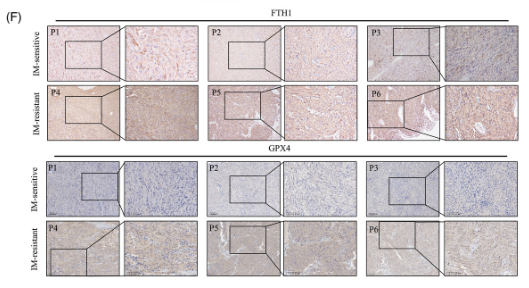 GPX4 Antibody - FIGURE 1 Imatinib resistance is associated with ferroptosis activity in gastrointestinal stromal tumour (GIST).