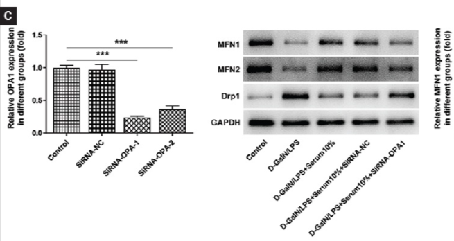 DRP1 Antibody - Figure 7 Niujiaodihuang Detoxify Decoction (NDD) medicated serum improves mitochondrial function via mitochondrial homeostasis regulated by the OMA1-OPA1 pathway in LO2 cells.