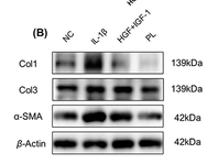 Collagen I Antibody - Figure 7 Rat PL and growth factors produced a significant antifibrosis effect on rat chondrocytes.