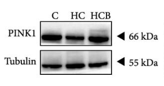 PINK1 Antibody - Figure 3 (C) Benfotiamine alleviates mitophagy disorder in the liver of M.