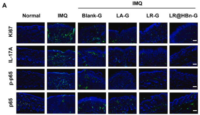 Phospho-NF-kB p65 (Ser536) Antibody - Fig.