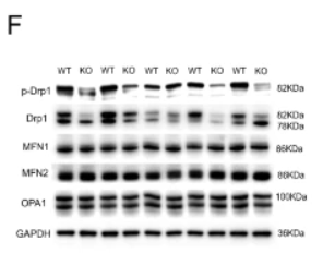 Phospho-DRP1 (Ser616) Antibody - Fig.