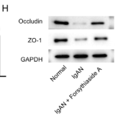 Occludin Antibody - FIGURE 3 Forsythiaside A alleviates intestinal barrier injury in IgAN model rats.