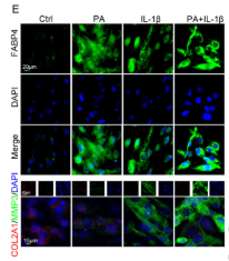 Collagen II Antibody - FIGURE 2 FABP4 played a critical role in mediating obesity-related IVDD.
