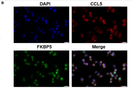 RANTES Antibody - Figure 5 Interaction between FKBP5 and CCL5.