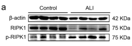 Phospho-RIPK1 (Ser166) Antibody - Fig.