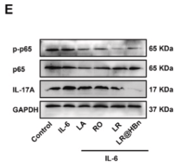 Phospho-NF-kB p65 (Ser536) Antibody - Fig.