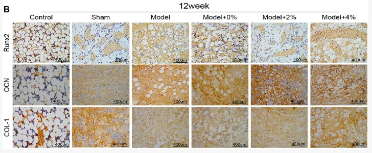 RUNX2 Antibody - FIGURE 5 The immumohistochemical staining for detecting the expression of Runx2, OCN and COL-1 at 4 (A) and 12 (B) weeks (400 ×).