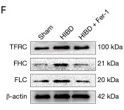 beta-Actin Antibody - Figure 4.