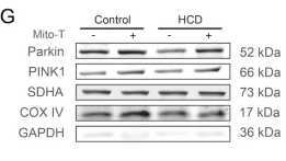 Parkin Antibody - Fig.