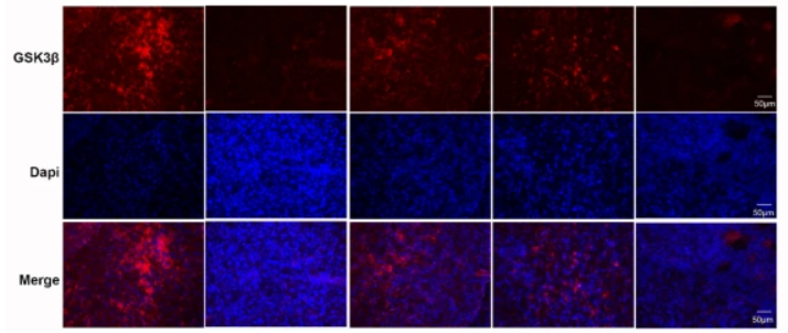GSK3 beta Antibody - Fig.