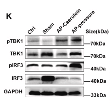 Phospho-IRF3 (Ser396) Antibody - Fig.