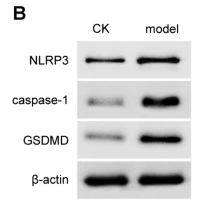Caspase 1 Antibody - Fig.