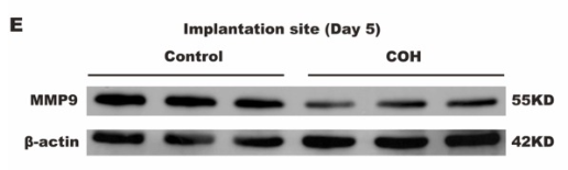 MMP9 Antibody - Fig.