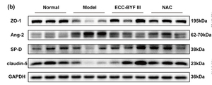 ZO 1 Antibody - Figure 5 ECC-BYF III improved the structural and functional damage of air-blood barrier through Nrf2 pathway.