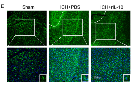 AIF1/IBA1 Antibody - FIGURE 5 Intranasal administration of recombinant interleukin-10 (rIL-10) improved neurologic function after intracerebral hemorrhage (ICH).