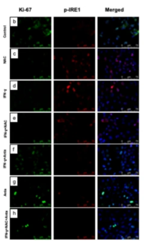 Phospho-IRE1 (Ser724) Antibody - Fig.