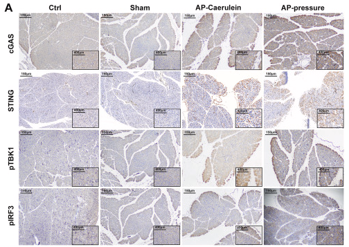 Phospho-TBK1 (Ser172) Antibody - Fig.