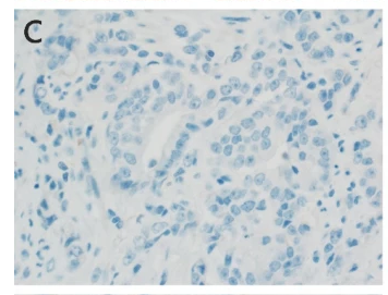 IL17RA Antibody - Fig.