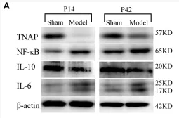 Alkaline Phosphatase Antibody - Figure 6 (A) Representative Western blot images of TNAP, IL-10, IL-6, and NF-κB in the injured cerebral cortex.