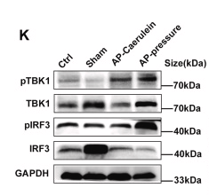 Phospho-IRF3 (Ser396) Antibody - Fig.