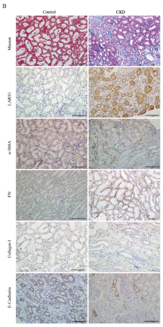 Collagen I Antibody - Fig.