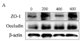 Occludin Antibody - FIGURE 2 Influence of ALA on the relative protein expression of ZO-1 and occludin in the jejunum and ileum of broilers.