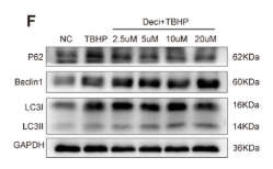 SQSTM1/p62 Antibody - Figure 3 Overexpression of Pon3 Attenuates Pyroptosis and Promotes Autophagy after SCI.