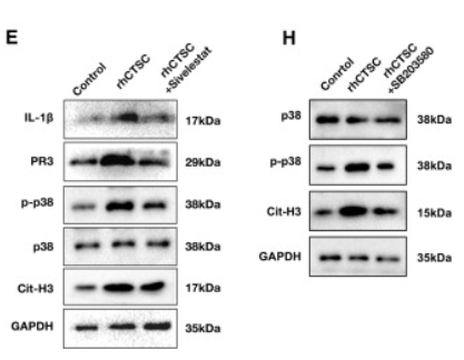 Phospho-p38 MAPK (Thr180/Tyr182) Antibody - Figure 5 Overexpression of CTSC in macrophages directly induced NET formation through the activation of the PR3-IL-1β-p38 pathway (A) The expression of membrane-bound PR3 was assessed by immunofluorescence after rhCTSC treatment (n = 3 per group).