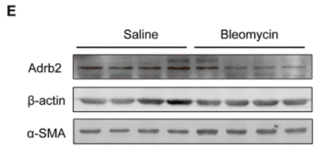beta-Actin Antibody - Fig.