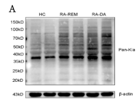 beta-Actin Antibody - Figure 2.