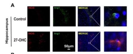 ARG1 Antibody - Fig.