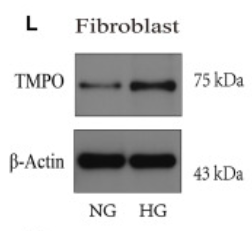 TMPO Antibody - Figure 8 Preliminary experimental validation (A–E) qRT-PCR to prove the expression of NUP107, SMC2, MCM4, NUP133, and TMPO in NG and HG by fibroblasts.