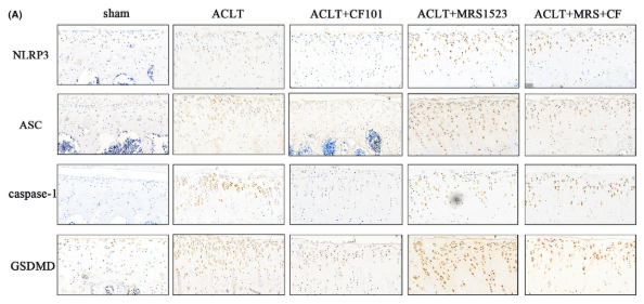 GSDMD Antibody - FIGURE 5 Activation of A3AR inhibited GSDMD cleavage and production of pro-inflammatory cytokines in articular cartilage in vivo.
