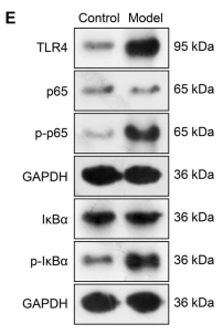Phospho-IKB alpha (Ser32/Ser36) Antibody - Fig.