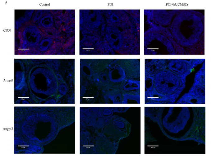 Angiopoietin 2 Antibody - Fig.