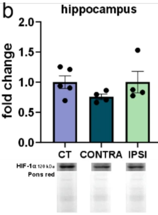 HIF1A Antibody - Fig.