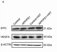 EPO Antibody - FIGURE 5 The effect of HIIT on the cerebral microangiogenesis in APP/PS1 mice.