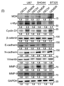 N Cadherin Antibody - FIGURE 4 MDK affects the ubiquitination modification of c-Myc and the Wnt/β-catenin signalling pathway.