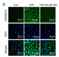 GSDMD N-Terminal Antibody(Mouse specific) - Figure 2 - HKL treatment notably inhibits pyroptosis in IEC-6 cells following H/R.
