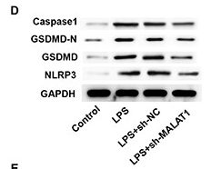 GSDMD N-Terminal Antibody(Mouse specific) - Figure 3 Malat1 regulates inflammation and pyroptosis in LPS-induced injury of mouse renal tubular epithelial cells.
