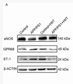 OGR1/GPR68 Antibody - FIGURE 6 The effect of HIIT on the cerebrovascular regulation of APP/PS1 mice.