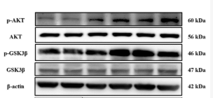 pan-AKT1/2/3 Antibody - Figure 4.
